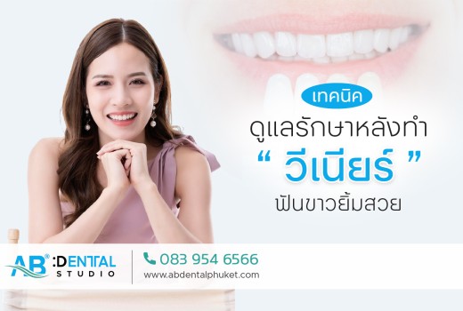 เทคนิคการดูแลวีเนียร์ฟัน อย่างถูกวิธี ที่ต้องรู้ก่อนสายเกินไป ?